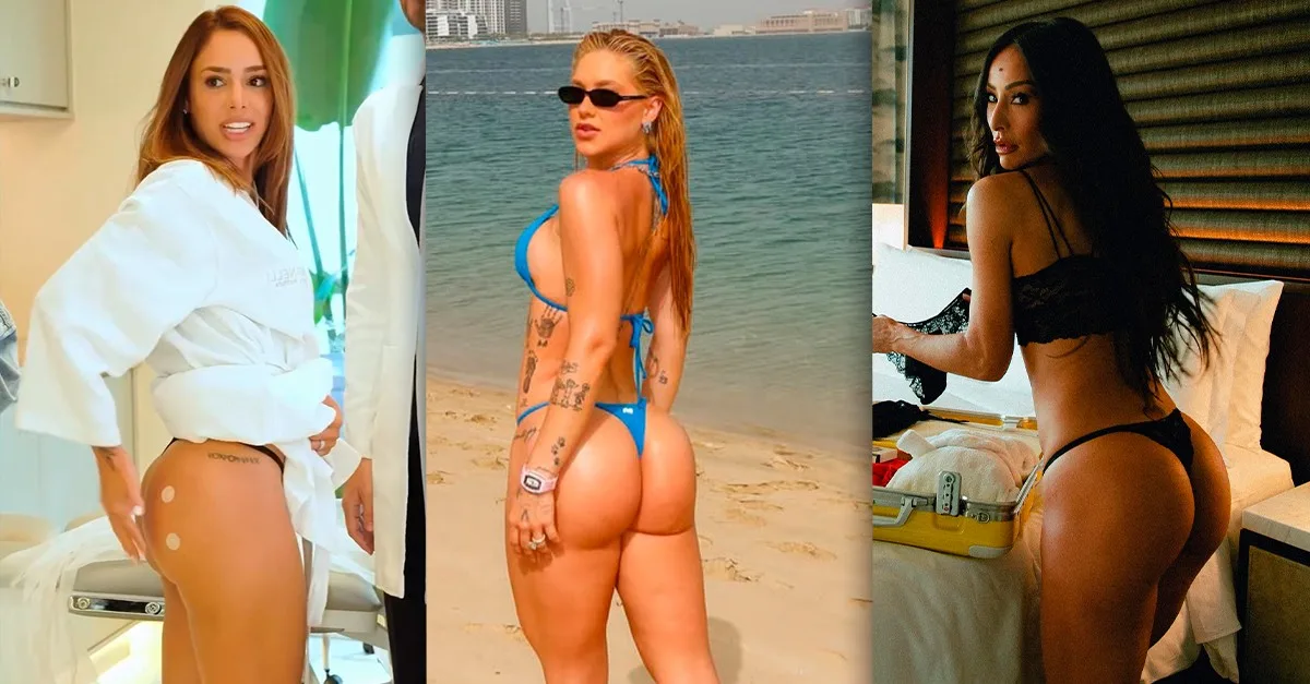 O que é o chamado “bumbum de colágeno” adotado por famosas