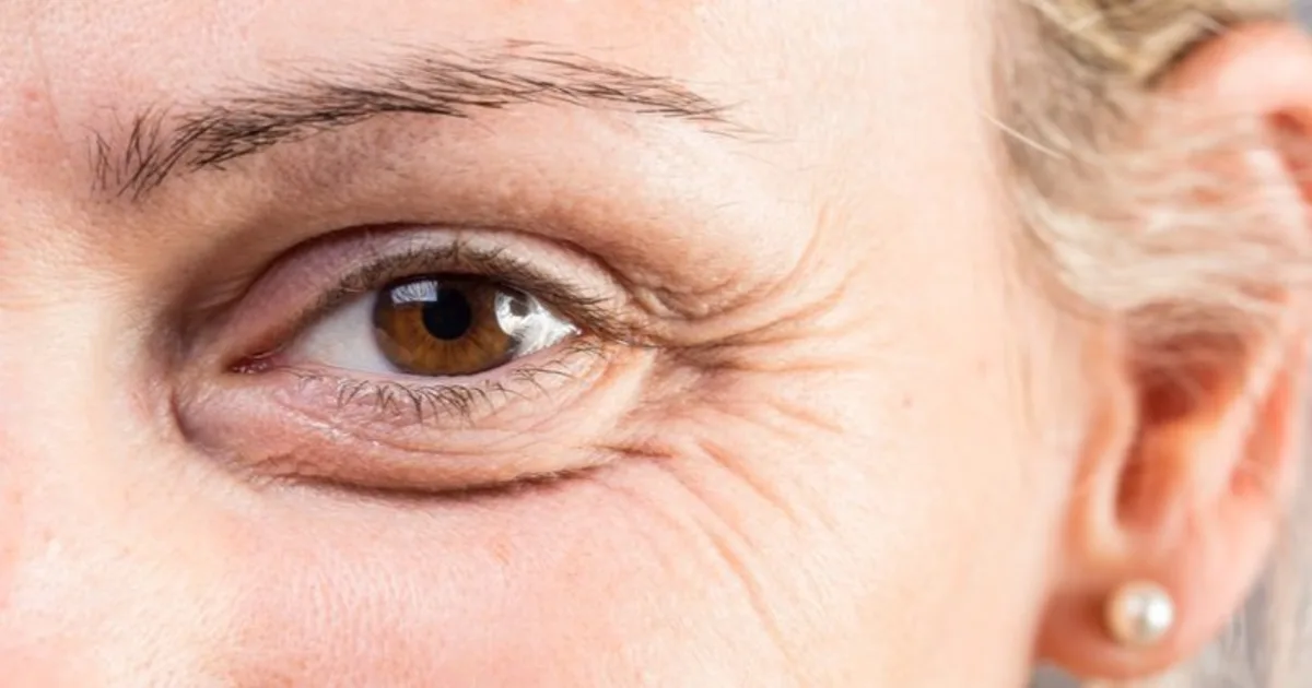 Retinol e proteção solar entram na rotina para cuidar da pele após os 40