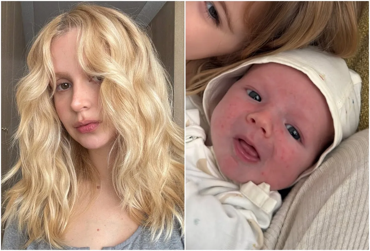 Isa Scherer troca óleo por creme de bebê após marcas no rosto de Tom