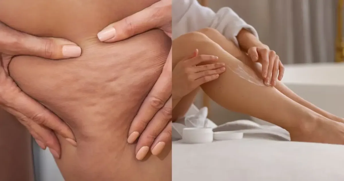 Loção Q10 da NIVEA foca firmeza e hidratação, mas não elimina celulite