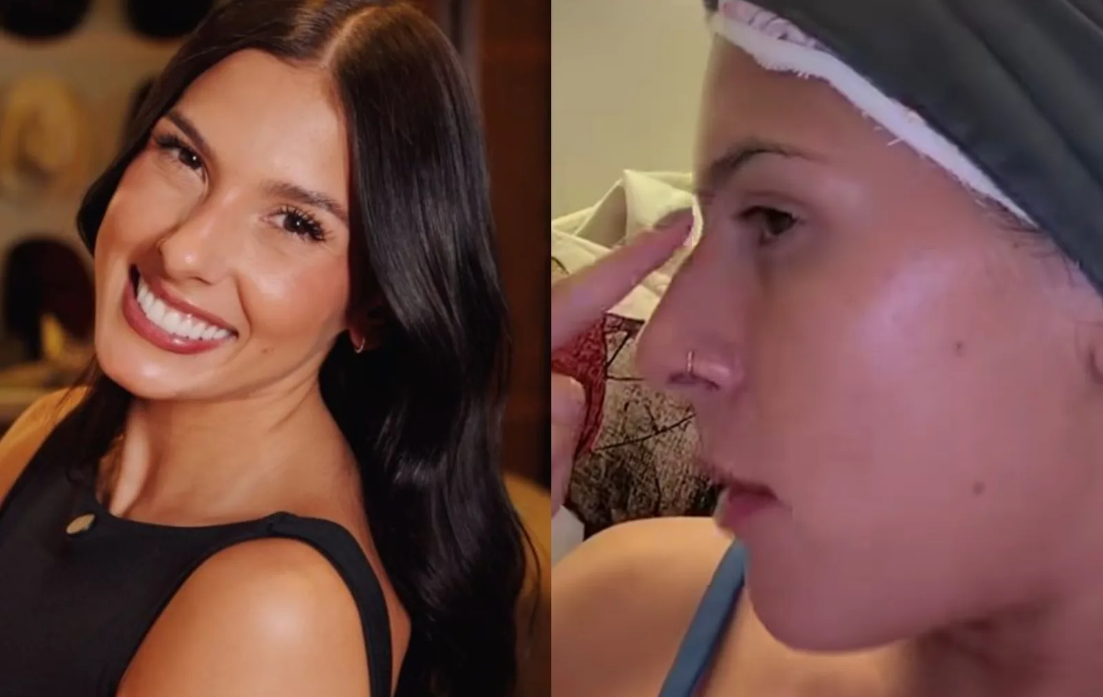 Ana Castela não quer mais colocar silicone e avalia mudar o nariz