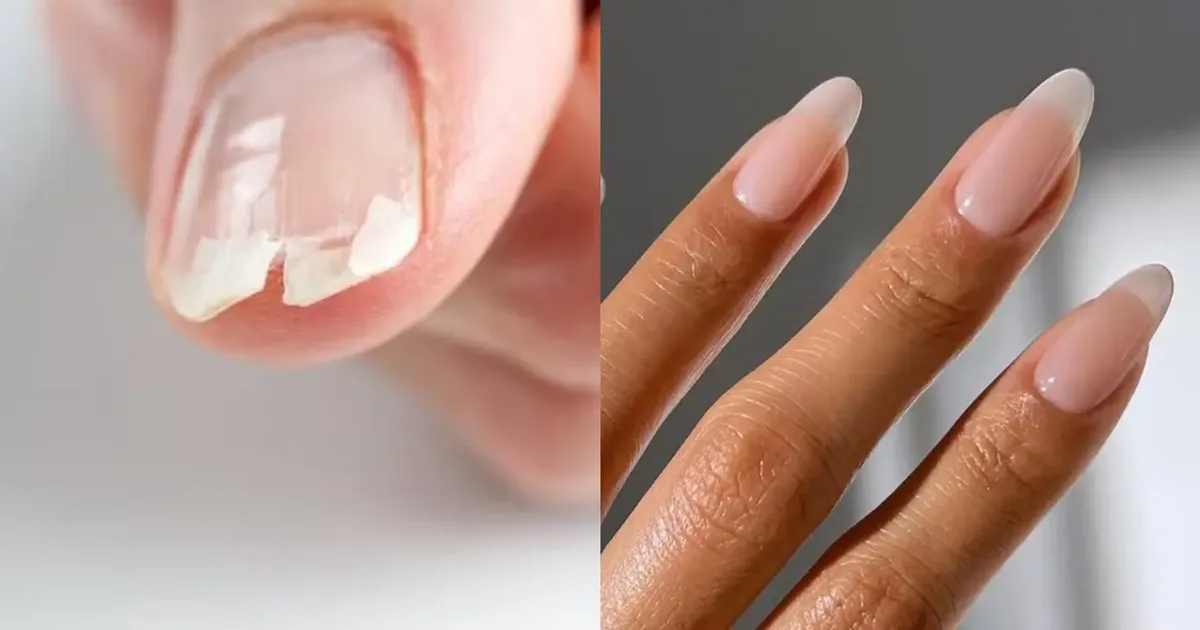 Creme nas mãos pode reduzir descamação e quebra das unhas