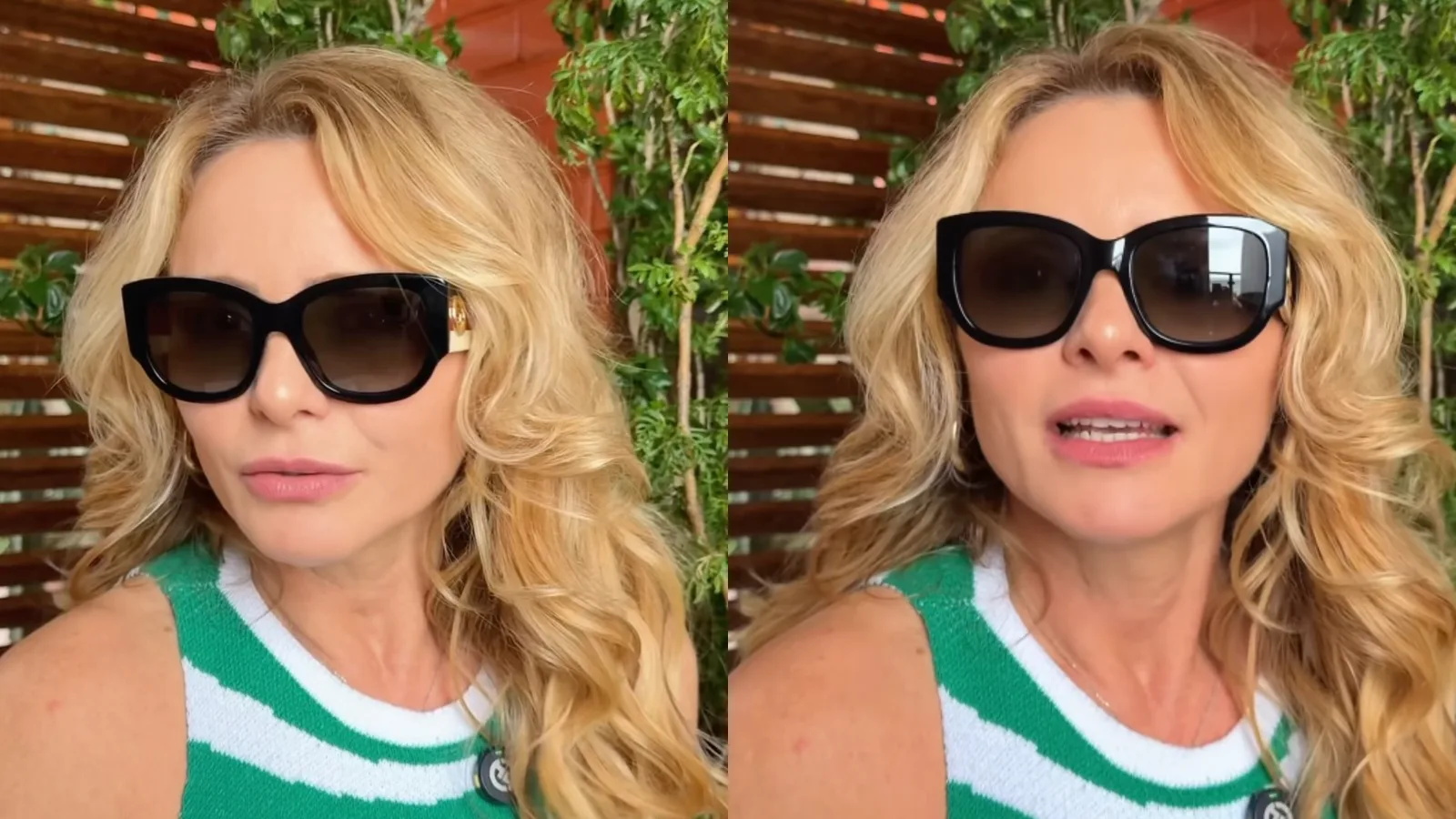 Rita Guedes denuncia complicações após blefaroplastia e alerta sobre escolha de médico
