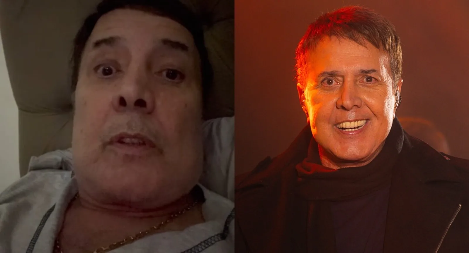 José Augusto diz que fez plástica e nega harmonização facial