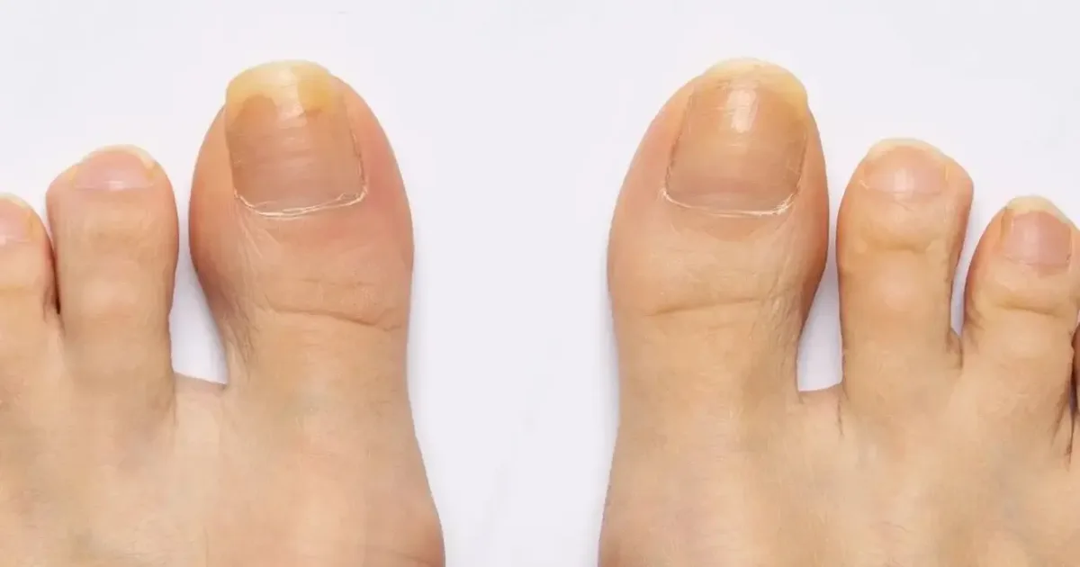 Esmalte nude valoriza unhas dos pés curtas com brilho e contornos limpos