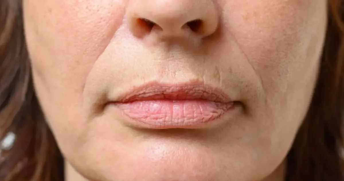 Bigode chinês: hábitos que deixam as linhas mais visíveis