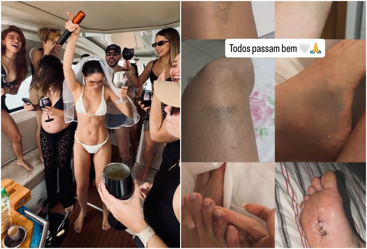 Juliette revela hematomas após despedida de solteira na Paraíba