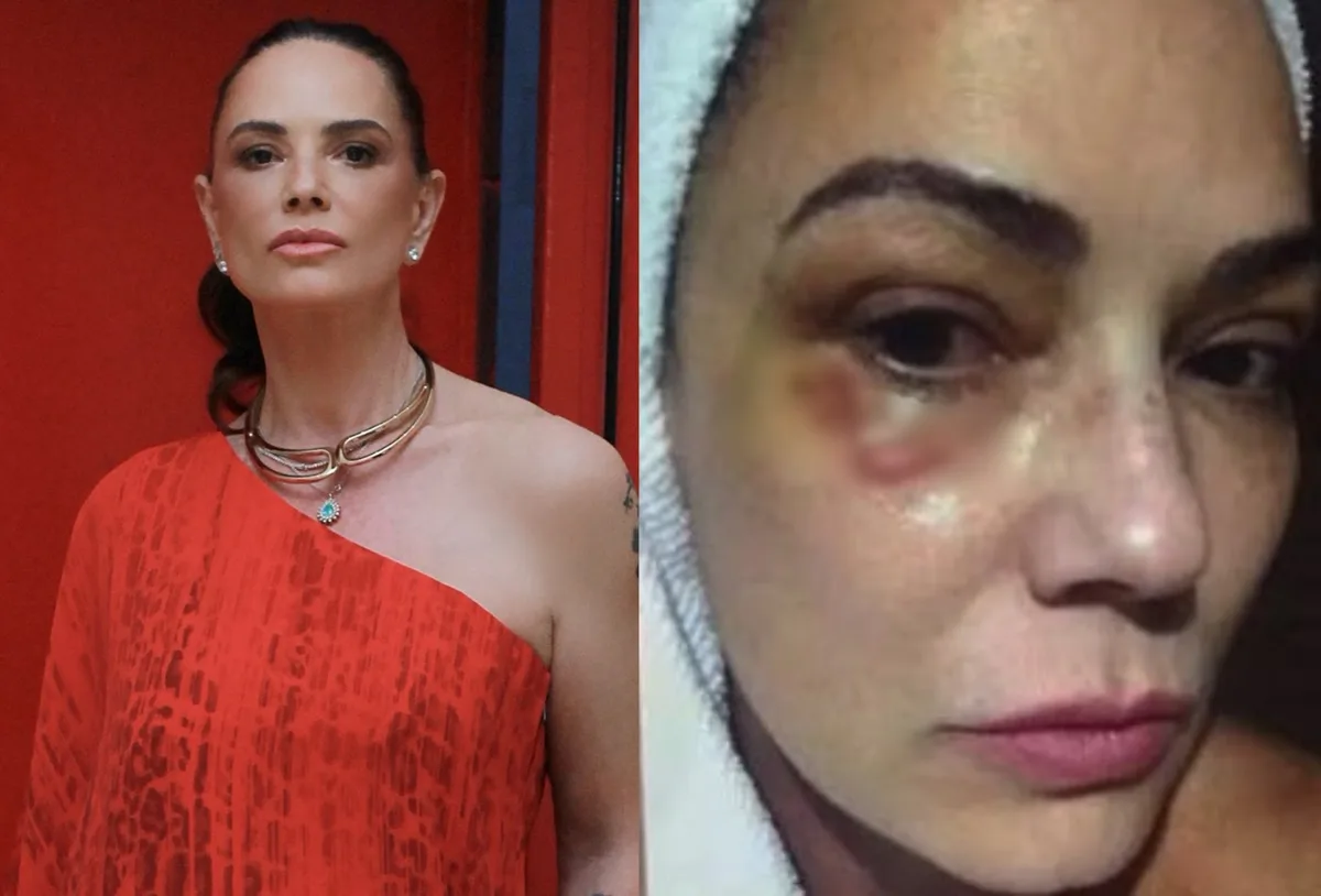 Luiza Brunet recorre contra indenização de R$ 150 mil por violência doméstica