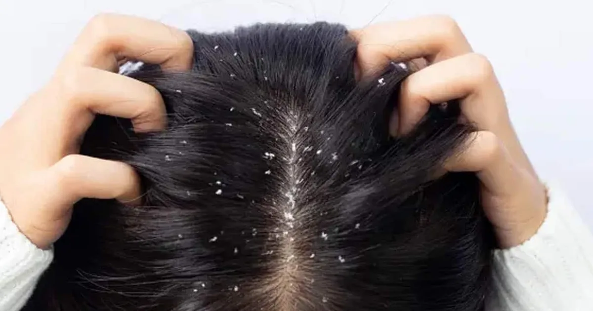 Shampoo em barra da Noviole promete reduzir oleosidade e descamação