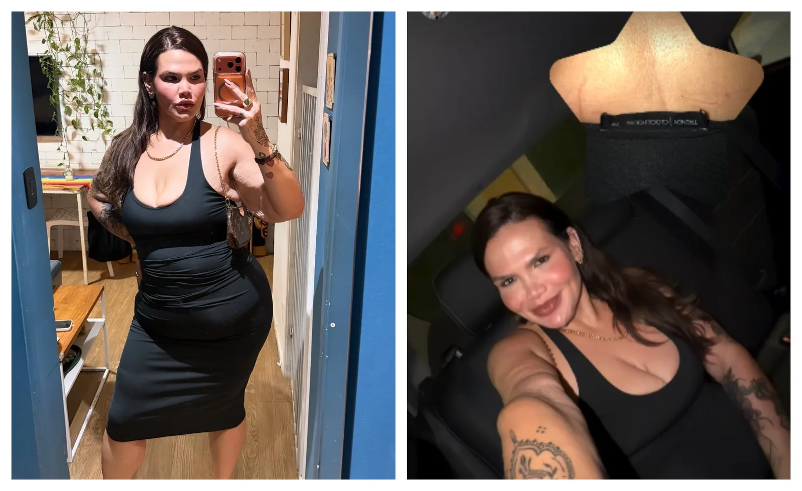 Thais Carla usa vestido PP e fala sobre novas cirurgias reparadoras